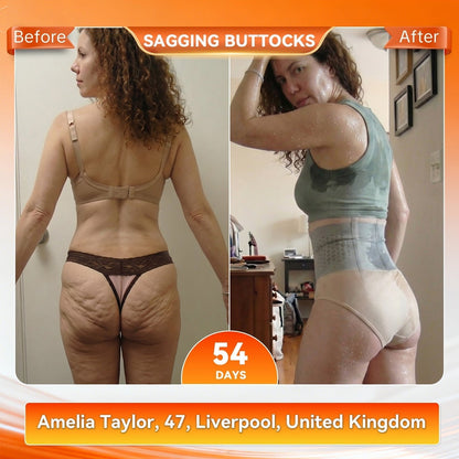 💦🍕BBOJI® 𝐌𝐨𝐫𝐢𝐧𝐠𝐚 & 𝐁𝐞𝐫𝐛𝐞𝐫𝐢𝐧𝐞 4‑In‑1 Micro‑Particle Sculpting & Fat‑Burn Shorts