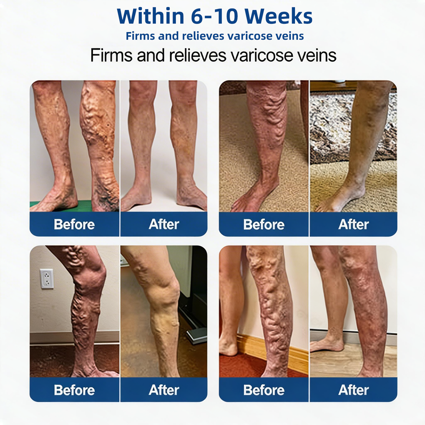 Alisanda® 𝑽𝗲𝗶𝙣 𝘾𝐨𝐧𝘁𝗼𝙪𝙧 𝙈𝙞𝐜𝐫𝒐𝒏𝒆𝗲𝗱𝗹𝙚 𝙋𝙖𝐭𝐜𝒉 𝒘𝒊𝘁𝗵 𝗔𝙙𝙫𝙖𝙣𝙘𝐞𝐝 𝐃𝒊𝒐𝒔𝗺𝙞𝐧 & 𝑯𝒆𝘀𝗽𝗲𝙧𝙞𝙙𝙞𝐧 𝐃𝒆𝒍𝒊𝒗𝗲𝗿𝙮🌿𝟕-𝐃𝐚𝐲 𝐕𝐢𝐬𝐢𝐛𝐥𝐞 𝐑𝐞𝐬𝐮𝐥𝐭𝐬 𝐟𝐨𝐫 𝐕𝐚𝐫𝐢𝐜𝐨𝐬𝐞 𝐕𝐞𝐢𝐧𝐬